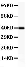 MCL1 / MCL 1 Antibody - MCL1 antibody Western blot. All lanes: Anti MCL1 at 0.5 ug/ml. WB: Recombinant Human MCL1 Protein 0.5ng. Predicted band size: 40 kD. Observed band size: 40 kD.