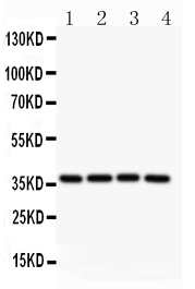 MCL1 / MCL 1 Antibody - Anti-MCL1 Picoband antibody, All lanes: Anti MCL1 at 0.5ug/ml Lane 1: Rat Spleen Tissue Lysate at 50ugLane 2: HEPG2 Whole Cell Lysate at 40ugLane 3: MCF-7 Whole Cell Lysate at 40ugLane 4: COLO320 Whole Cell Lysate at 40ug Predicted bind size: 37KD Observed bind size: 37KD