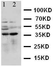 MCL1 / MCL 1 Antibody - WB of MCL1 / MCL 1 antibody. Lane 1: HELA Cell Lysate. Lane 2: MCF-7 Cell Lysate.