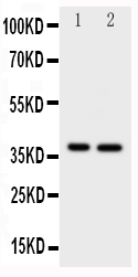 MCL1 / MCL 1 Antibody - Anti-MCL1 antibody, Western blotting All lanes: Anti MCL1 at 0.5ug/ml Lane 1: HELA Whole Cell Lysate at 40ug Lane 2: MCF-7 Whole Cell Lysate at 40ug Predicted bind size: 37KD Observed bind size: 37KD