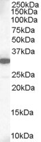 MCL1 / MCL 1 Antibody - Antibody staining (1 ug/ml) of Human Lung lysate (RIPA buffer, 35 ug total protein per lane). Primary incubated for 1 hour. Detected by Western blot of chemiluminescence.