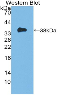 MCL1 / MCL 1 Antibody - Western blot of recombinant MCL1 / MCL 1.