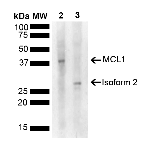 MCL1 / MCL 1 Antibody - Western blot analysis of Rat, Mouse Liver showing detection of 37.3 kDa MCL1 protein using Rabbit Anti-MCL1 Polyclonal Antibody. Lane 1: Molecular Weight Ladder (MW). Lane 2: Rat Liver. Lane 3: Mouse Liver. Load: 15 µg. Block: 5% Skim Milk powder in TBST. Primary Antibody: Rabbit Anti-MCL1 Polyclonal Antibody  at 1:1000 for 2 hours at RT with shaking. Secondary Antibody: Goat Anti-Rabbit IgG: HRP at 1:5000 for 1 hour at RT. Color Development: ECL solution for 5 min at RT. Predicted/Observed Size: 37.3 kDa. Other Band(s): 28.6 kDa.