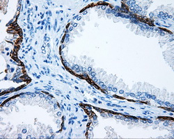 MCL1 / MCL 1 Antibody - IHC of paraffin-embedded prostate tissue using anti-MCL1 mouse monoclonal antibody. (Dilution 1:50).