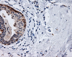MCL1 / MCL 1 Antibody - IHC of paraffin-embedded breast tissue using anti-MCL1 mouse monoclonal antibody. (Dilution 1:50).