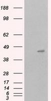 MCL1 / MCL 1 Antibody - HEK293T cells were transfected with the pCMV6-ENTRY control (Left lane) or pCMV6-ENTRY MCL1 (Right lane) cDNA for 48 hrs and lysed. Equivalent amounts of cell lysates (5 ug per lane) were separated by SDS-PAGE and immunoblotted with anti-MCL1.