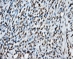 MCL1 / MCL 1 Antibody - IHC of paraffin-embedded endometrium tissue using anti-MCL1 mouse monoclonal antibody. (Dilution 1:50).
