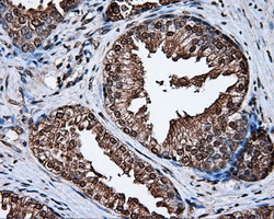MCL1 / MCL 1 Antibody - IHC of paraffin-embedded prostate tissue using anti-MCL1 mouse monoclonal antibody. (Dilution 1:50).