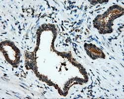 MCL1 / MCL 1 Antibody - IHC of paraffin-embedded prostate tissue using anti-MCL1 mouse monoclonal antibody. (Dilution 1:50).