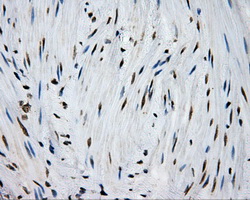 MCL1 / MCL 1 Antibody - IHC of paraffin-embedded colon tissue using anti-MCL1 mouse monoclonal antibody. (Dilution 1:50).