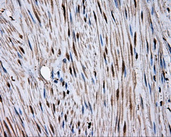 MCL1 / MCL 1 Antibody - Immunohistochemical staining of paraffin-embedded colon tissue using anti-MCL1 mouse monoclonal antibody. (Dilution 1:50).