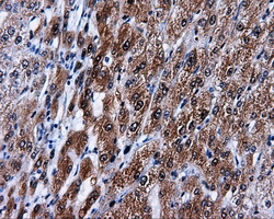 MCL1 / MCL 1 Antibody - Immunohistochemical staining of paraffin-embedded liver tissue using anti-MCL1 mouse monoclonal antibody. (Dilution 1:50).
