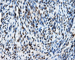 MCL1 / MCL 1 Antibody - Immunohistochemical staining of paraffin-embedded endometrium tissue using anti-MCL1 mouse monoclonal antibody. (Dilution 1:50).