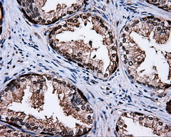 MCL1 / MCL 1 Antibody - Immunohistochemical staining of paraffin-embedded prostate tissue using anti-MCL1 mouse monoclonal antibody. (Dilution 1:50).