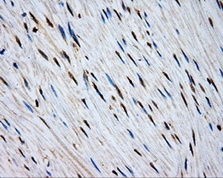 MCL1 / MCL 1 Antibody - IHC of paraffin-embedded colon tissue using anti-MCL1 mouse monoclonal antibody. (Dilution 1:50).