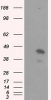 MCL1 / MCL 1 Antibody - HEK293T cells were transfected with the pCMV6-ENTRY control (Left lane) or pCMV6-ENTRY MCL1 (Right lane) cDNA for 48 hrs and lysed. Equivalent amounts of cell lysates (5 ug per lane) were separated by SDS-PAGE and immunoblotted with anti-MCL1.