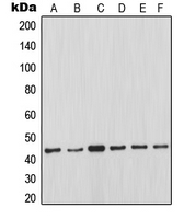 MCL1 / MCL 1 Antibody - Western blot analysis of MCL1 expression in Ramos (A); JAR (B); K562 (C); Jurkat (D); Raji (E); HeLa (F) whole cell lysates.