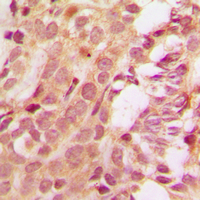 MCL1 / MCL 1 Antibody - Immunohistochemical analysis of MCL1 staining in human tonsil formalin fixed paraffin embedded tissue section. The section was pre-treated using heat mediated antigen retrieval with sodium citrate buffer (pH 6.0). The section was then incubated with the antibody at room temperature and detected using an HRP conjugated compact polymer system. DAB was used as the chromogen. The section was then counterstained with hematoxylin and mounted with DPX.