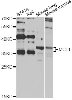MCL1 / MCL 1 Antibody - Western blot analysis of extracts of various cell lines, using MCL1 antibody at 1:1000 dilution. The secondary antibody used was an HRP Goat Anti-Rabbit IgG (H+L) at 1:10000 dilution. Lysates were loaded 25ug per lane and 3% nonfat dry milk in TBST was used for blocking. An ECL Kit was used for detection and the exposure time was 30s.