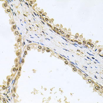 MCL1 / MCL 1 Antibody - Immunohistochemistry of paraffin-embedded human prostate using MCL1 antibodyat dilution of 1:100 (40x lens).