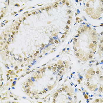 MCL1 / MCL 1 Antibody - Immunohistochemistry of paraffin-embedded human stomach using MCL1 antibodyat dilution of 1:100 (40x lens).