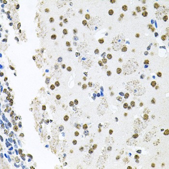 MCL1 / MCL 1 Antibody - Immunohistochemistry of paraffin-embedded mouse brain using MCL1 antibodyat dilution of 1:100 (40x lens).
