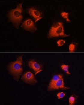 MCL1 / MCL 1 Antibody - Immunofluorescence analysis of A431 cells using MCL1 antibodyat dilution of 1:100 (40x lens). Blue: DAPI for nuclear staining.