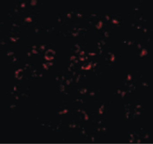 MCL1 / MCL 1 Antibody - Immunofluorescence of Mcl-1 in Raji cells with Mcl-1 antibody at 20 ug/ml.