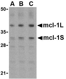 MCL1 / MCL 1 Antibody - Western blot of Mcl-1 in Raji cell lysates with Mcl-1 antibody at (A) 0.5, (B) 1, and (C) 2 ug/ml.