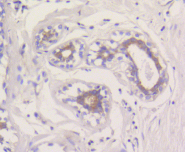 MCL1 / MCL 1 Antibody - Immunohistochemistry of paraffin-embedded human breast using MCL1 antibodyat dilution of 1:100 (40x lens).