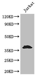 MCL1 / MCL 1 Antibody - Positive WB detected in:Jurkat whole cell lysate;All lanes: MCL1 antibody at 3.2ug/ml;Secondary;Goat polyclonal to rabbit IgG at 1/50000 dilution;Predicted band size: 38,29 kDa;Observed band size: 38 kDa;