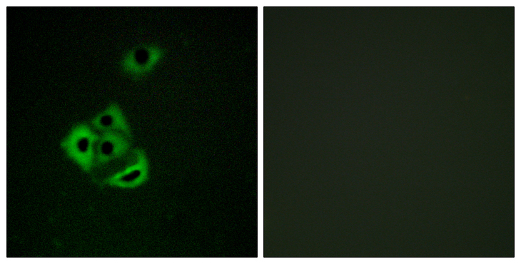 MCL1 / MCL 1 Antibody - Immunofluorescence analysis of A549 cells, using MCL1 (Phospho-Ser159) Antibody. The picture on the right is blocked with the phospho peptide.