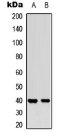 MCL1 / MCL 1 Antibody - Western blot analysis of MCL1 (pS159) expression in K562 (A); human liver (B) whole cell lysates.