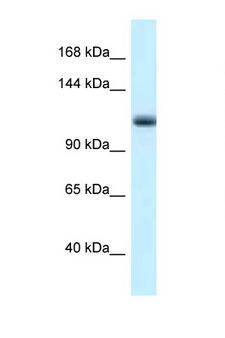 MCM10 Antibody - MCM10 antibody Western blot of Mouse Pancreas lysate. Antibody concentration 1 ug/ml.  This image was taken for the unconjugated form of this product. Other forms have not been tested.