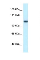 MCM10 Antibody - MCM10 antibody Western blot of Mouse Pancreas lysate. Antibody concentration 1 ug/ml.  This image was taken for the unconjugated form of this product. Other forms have not been tested.