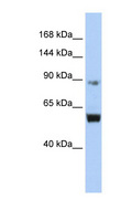 MCM10 Antibody - MCM10 antibody Western blot of Jurkat lysate. This image was taken for the unconjugated form of this product. Other forms have not been tested.