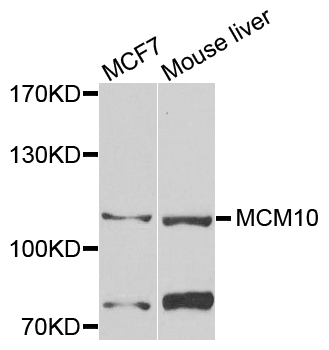 MCM10 Antibody - Western blot analysis of extracts of various cells.