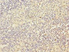 MCM10 Antibody - Immunohistochemistry of paraffin-embedded human spleen tissue at dilution 1:100