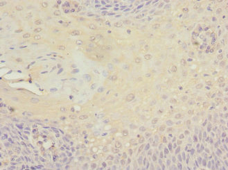 MCM10 Antibody - Immunohistochemistry of paraffin-embedded human tonsil tissue at dilution 1:100