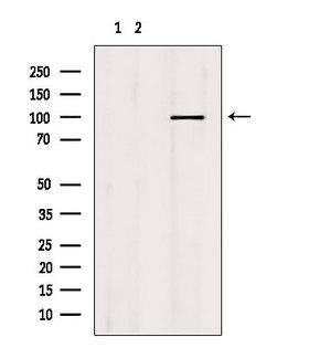 MCM10 Antibody - Western blot analysis of extracts of mouse brain tissue using MCM10 antibody. Lane 1 was treated with the blocking peptide.