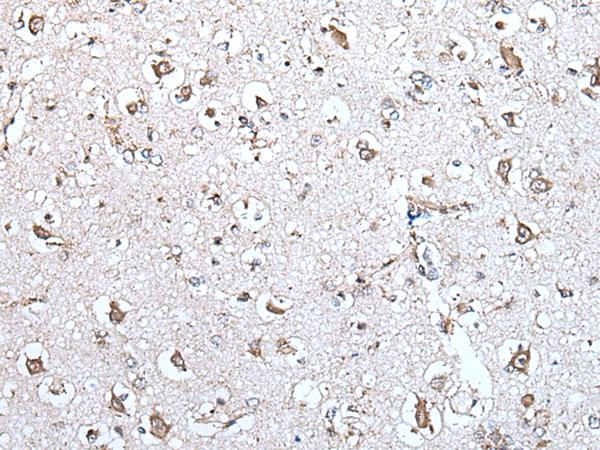 MCM10 Antibody - Immunohistochemistry of paraffin-embedded Human brain tissue  using MCM10 Polyclonal Antibody at dilution of 1:45(×200)