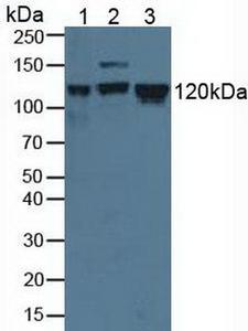 MCM2 Antibody - Western Blot;Sample: Lane1: Human K562 Cells; Lane2: Human Hela Cells; Lane3: Human Jurkat Cells.