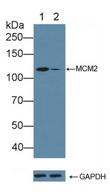 MCM2 Antibody - Knockout Varification: Lane 1: Wild-type K562 cell lysate; Lane 2: MCM2 knockout K562 cell lysate; Predicted MW: 101kd Observed MW: 120kd Primary Ab: 3µg/ml Rabbit Anti-Human MCM2 Antibody Second Ab: 0.2µg/mL HRP-Linked Caprine Anti-Rabbit IgG Polyclonal Antibody