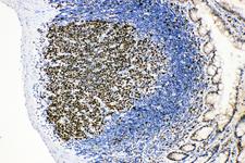 MCM2 Antibody - MCM2 antibody. IHC(P): Rat Intestinal lymphocyte Tissue.
