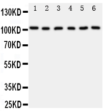 MCM2 Antibody - Anti-MCM2 antibody, Western blotting All lanes: Anti MCM2 at 0.5ug/ml Lane 1: Rat Testis Tissue Lysate at 50ug Lane 2: Rat Kidney Tissue Lysate at 50ug Lane 3: Mouse Intestine Tissue Lysate at 50ug Lane 4: Mouse Testis Tissue Lysate at 50ug Lane 5: Mouse Ovary Tissue Lysate at 50ug Lane 6: Mouse Kidney Tissue Lysate at 50ug Predicted bind size: 102KD Observed bind size: 102KD