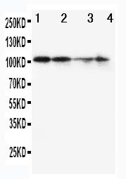 MCM2 Antibody - WB of MCM2 antibody. All lanes: Anti-MCM2 at 0.5ug/ml. Lane 1: SW620 Whole Cell Lysate at 40ug. Lane 2: PANC Whole Cell Lysate at 40ug. Lane 3: JURKAT Whole Cell Lysate at 40ug. Lane 4: HELA Whole Cell Lysate at 40ug. Predicted bind size: 102KD. Observed bind size: 102KD.