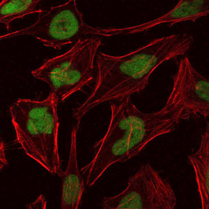MCM2 Antibody - Immunofluorescence of HeLa cells using MCM2 mouse monoclonal antibody (green). Blue: DRAQ5 fluorescent DNA dye. Red: Actin filaments have been labeled with Alexa Fluor-555 phalloidin.