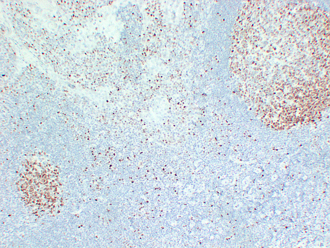 MCM2 Antibody - Tonsil 2