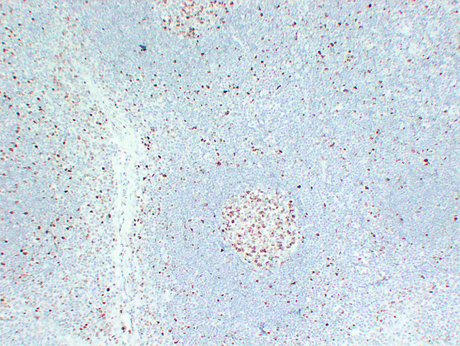 MCM2 Antibody - Tonsil 3