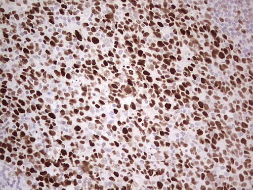 MCM2 Antibody - IHC of paraffin-embedded Human tonsil using anti-MCM2 mouse monoclonal antibody. (Heat-induced epitope retrieval by 1 mM EDTA in 10mM Tris, pH8.5, 120°C for 3min).